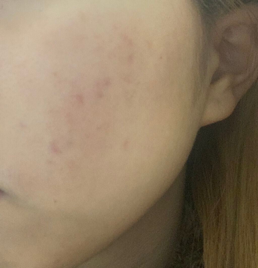 極潤ヒアルロン液(ハダラボモイスト化粧水d)/肌ラボ/化粧水を使ったクチコミ(1枚目)