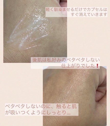 アトバリア365クリーム/AESTURA/フェイスクリームを使ったクチコミ(3枚目)