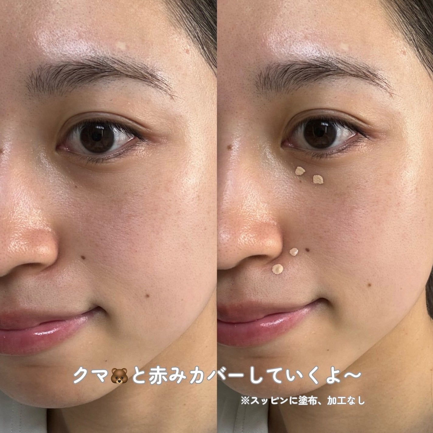 ダーマシンコンシーラー/23years old/リキッドコンシーラーを使ったクチコミ(4枚目)