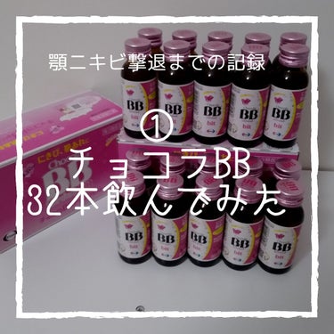 チョコラBB チョコラBBドリンクビット（医薬品）のクチコミ「チョコラBB　bitを32本飲んだ結果
※before after 写真有り。


半年前から.....」（1枚目）