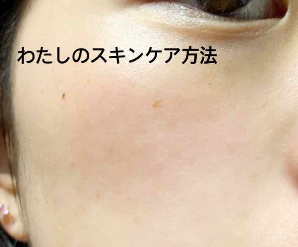 ハトムギ化粧水(ナチュリエ スキンコンディショナー R )/ナチュリエ/化粧水を使ったクチコミ（1枚目）