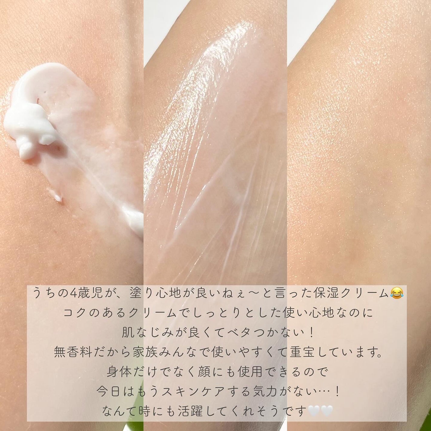 モイスチャライジング クリーム/セタフィル/ボディクリームを使ったクチコミ(4枚目)