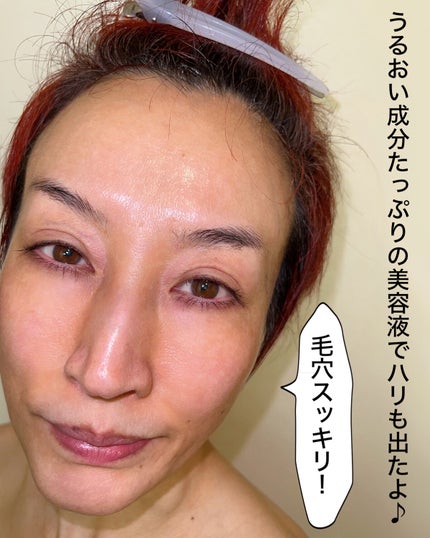 ポアクレンズバブルマスク/ポアレスラボ/シートマスク・パックを使ったクチコミ(7枚目)