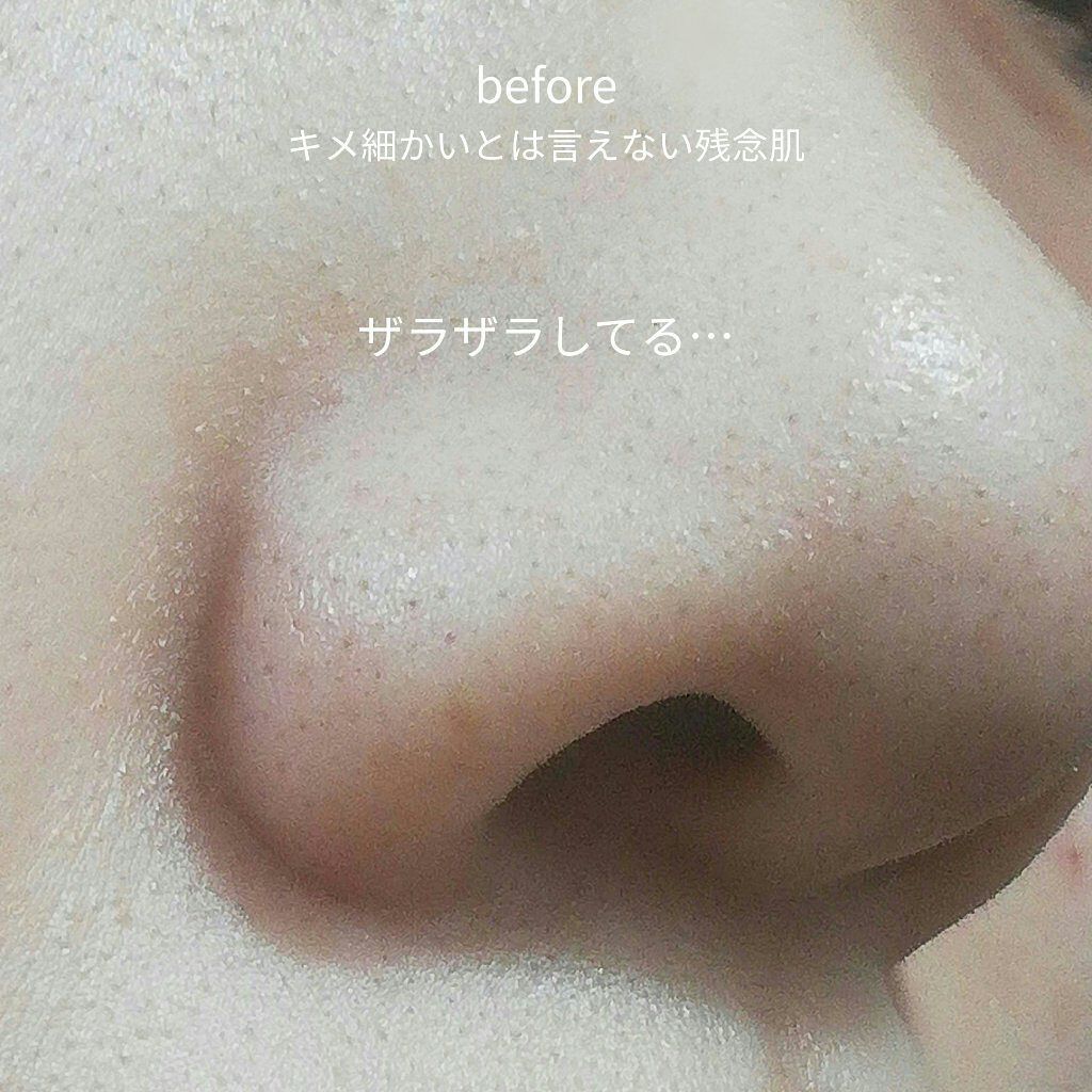 ノーモアブラックヘッド(ノーズピーリング)/One-day's you/スクラブ・ゴマージュを使ったクチコミ(2枚目)