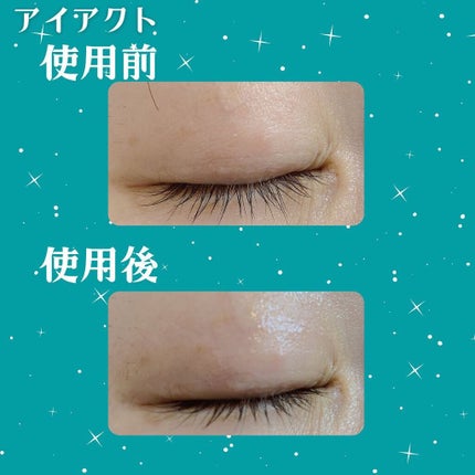 てぃ⋈コスメlover on LIPS 「.⋆⸜年齢とともに下がってくる"まぶた専用"アイクリーム✨⸝⋆..」(4枚目)