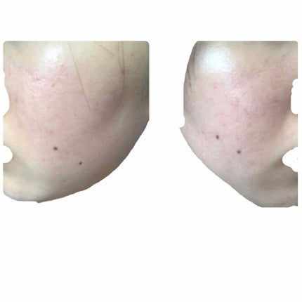 CICA クリーム/VT/フェイスクリームを使ったクチコミ(3枚目)