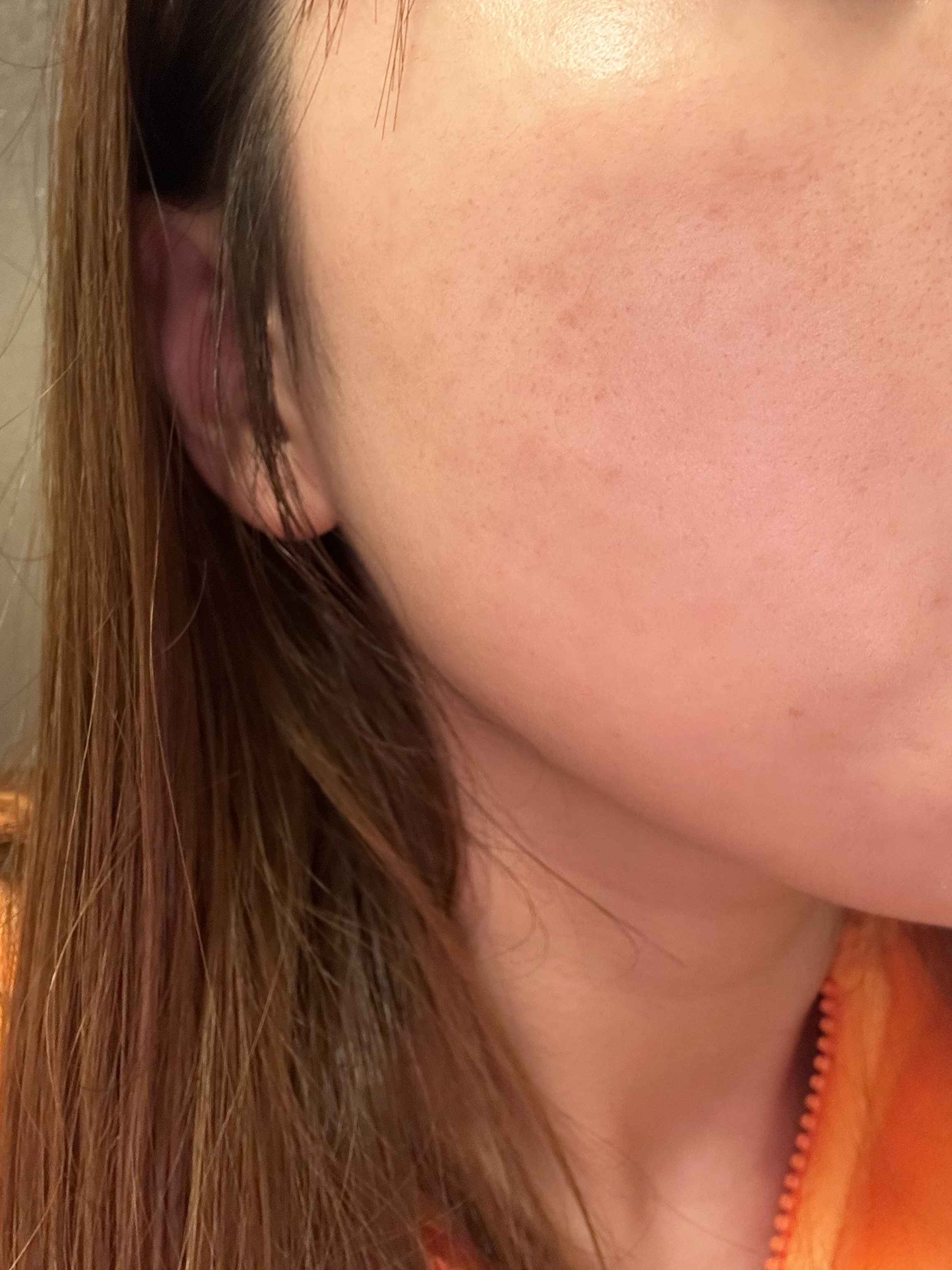 ディープビタCパッド/MEDICUBE/トナーパッドを使ったクチコミ（2枚目）