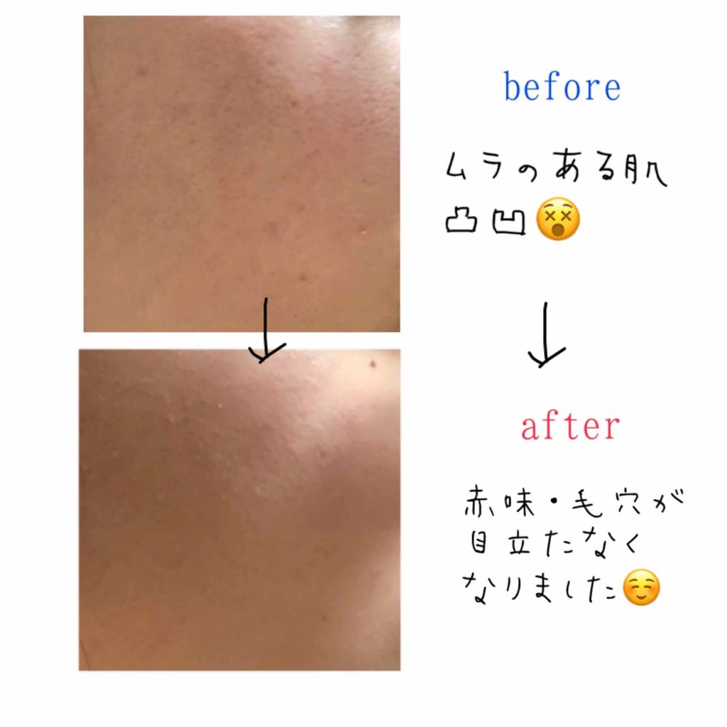 NUDISM MOIST COVER CUSHION/CLIO/クッションファンデーションを使ったクチコミ(3枚目)