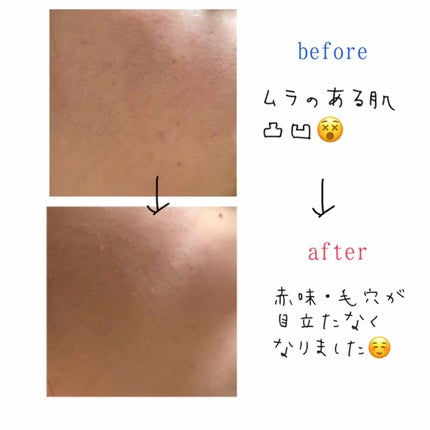 NUDISM MOIST COVER CUSHION/CLIO/クッションファンデーションを使ったクチコミ(3枚目)