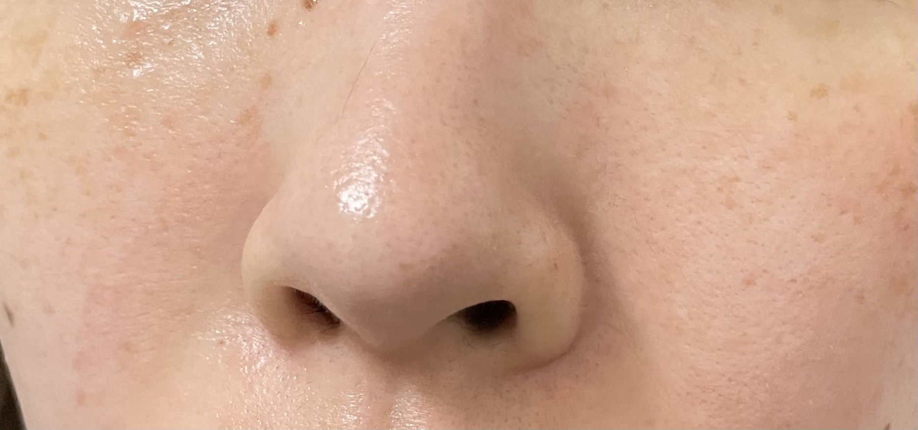 CICAプレミアムケアマスク/MDSKIN LABO/シートマスク・パックを使ったクチコミ（2枚目）