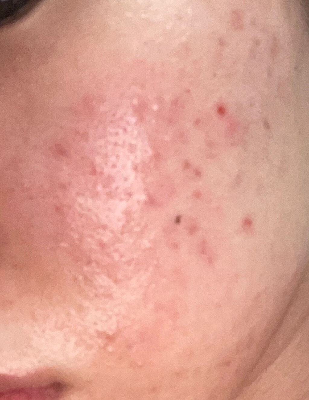 白潤 薬用美白化粧水/肌ラボ/化粧水を使ったクチコミ（2枚目）