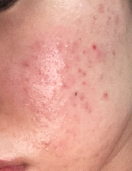 CICA デイリースージングマスク/VT/シートマスク・パックを使ったクチコミ(2枚目)