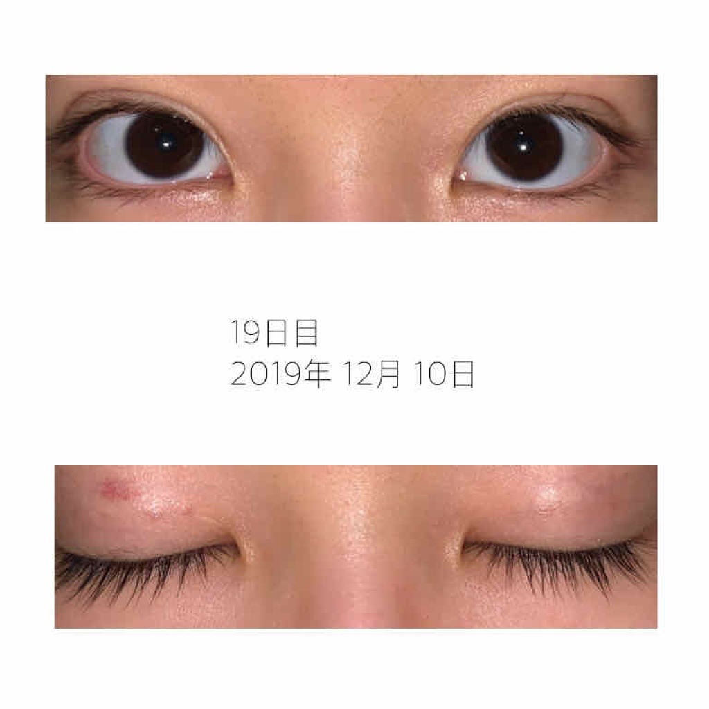 オリジナル ピュアスキンジェリー/ヴァセリン/ボディクリームを使ったクチコミ(3枚目)