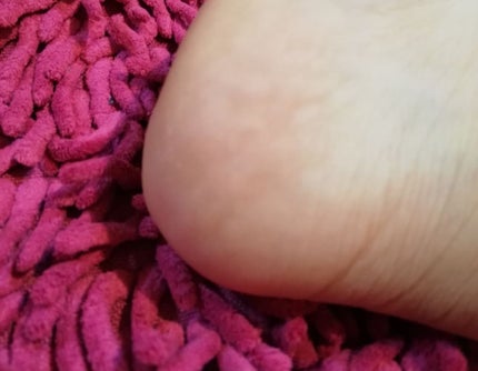 薬用 フットソープF1 フレッシュハーブ/フットメジ/レッグ・フットケアを使ったクチコミ(4枚目)