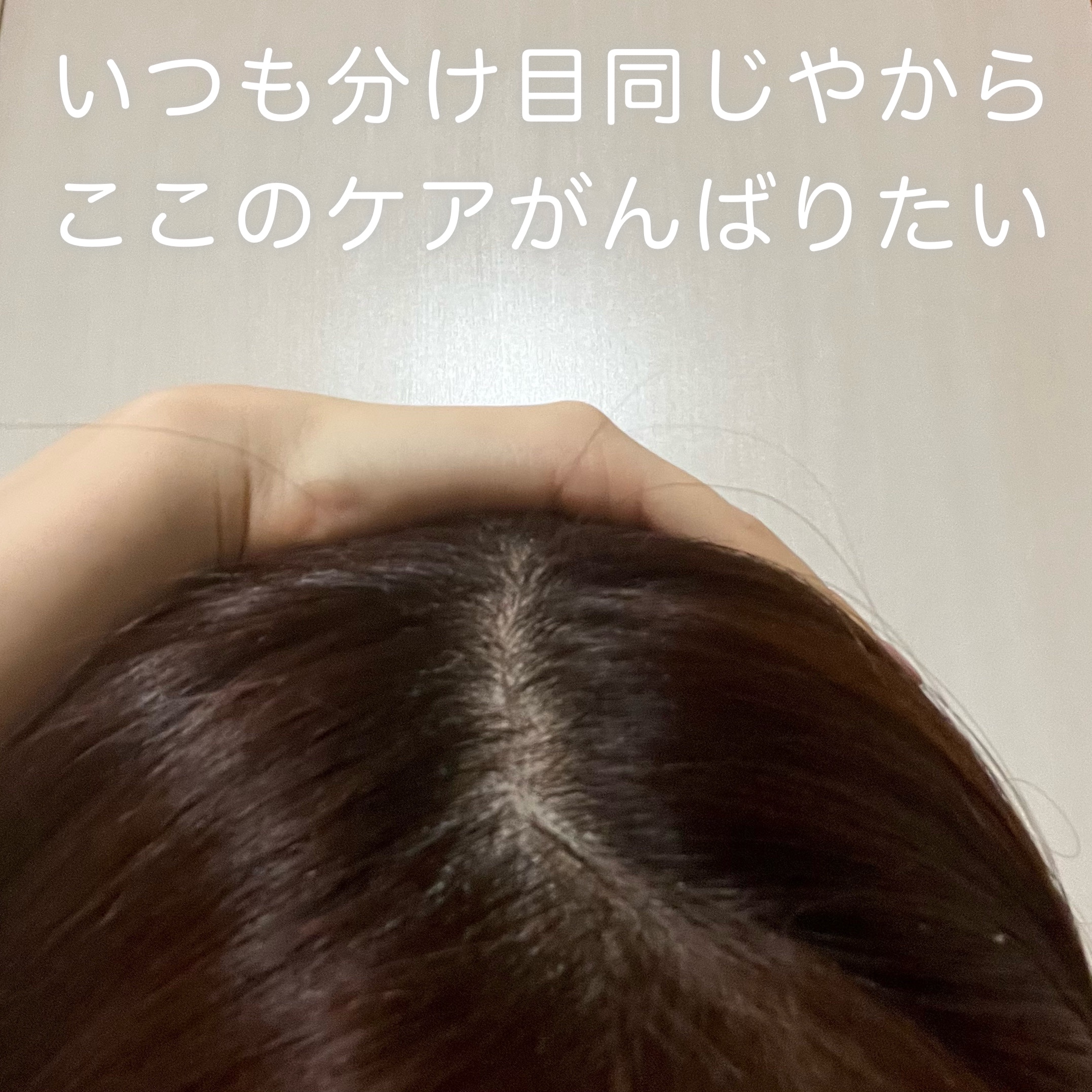 薬用スカルプセラム/wicot/頭皮ローションを使ったクチコミ（3枚目）