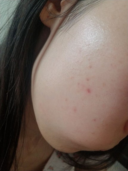 フローレス フィット/COVERMARK/クリーム・エマルジョンファンデーションを使ったクチコミ(2枚目)