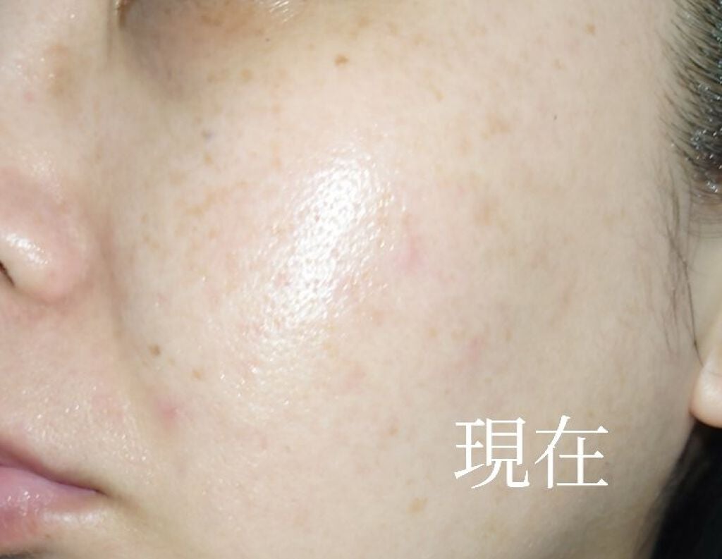 明色美顔水 薬用化粧水/美顔/化粧水を使ったクチコミ(3枚目)