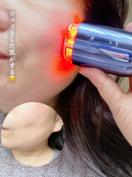 まい on LIPS 「⑅⿻ダウンタイム知らずの「家でできるインモード」と話題の美顔器..」(6枚目)