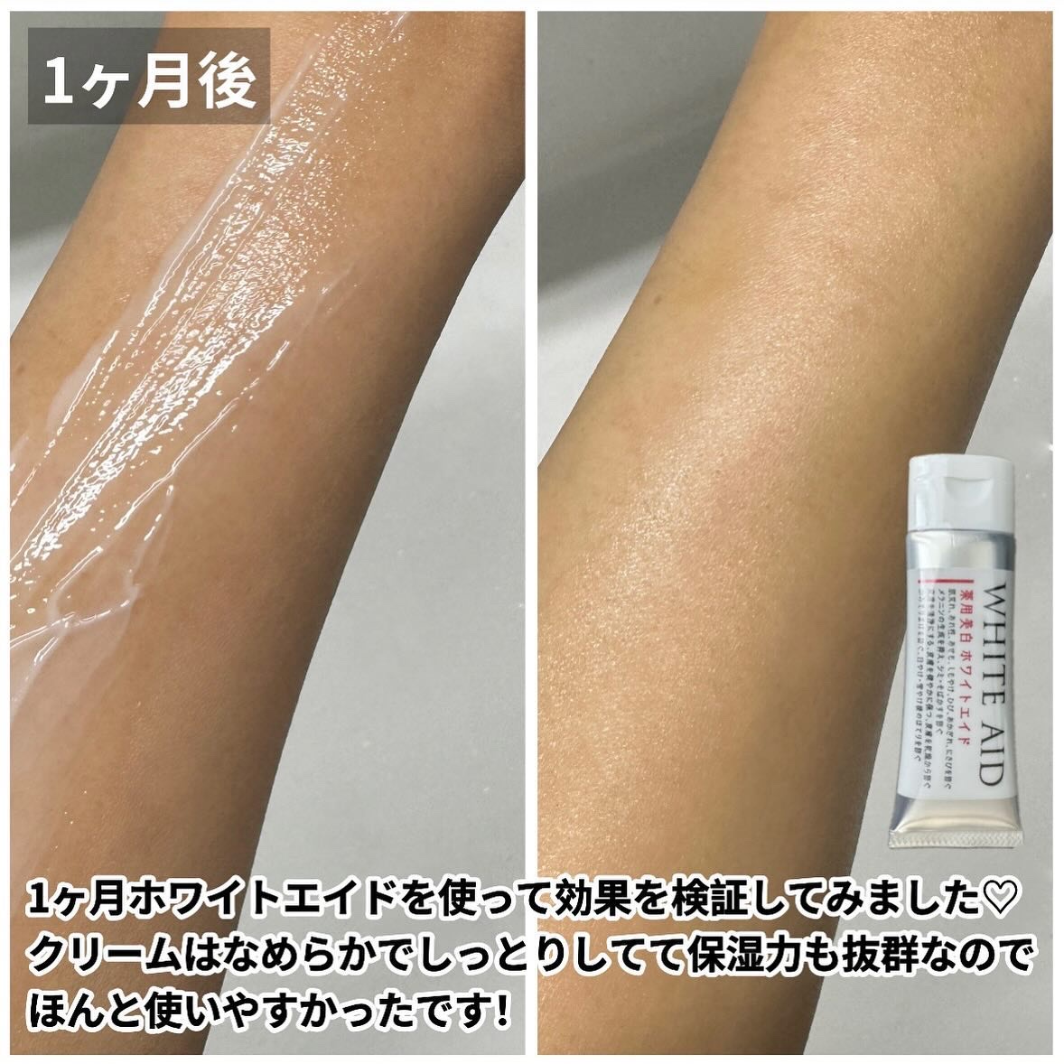 薬用美白WHITE+AIDe/Nalelu(ナレル)/フェイスクリームを使ったクチコミ（2枚目）