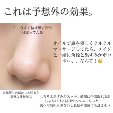 muo クレンジングオイルのクチコミ「8つの無添加で肌に優しくスッキリメイクオフ✨そして鼻の黒ずみがポロポロ取れた…！！ミュオのクレ.....」（3枚目）