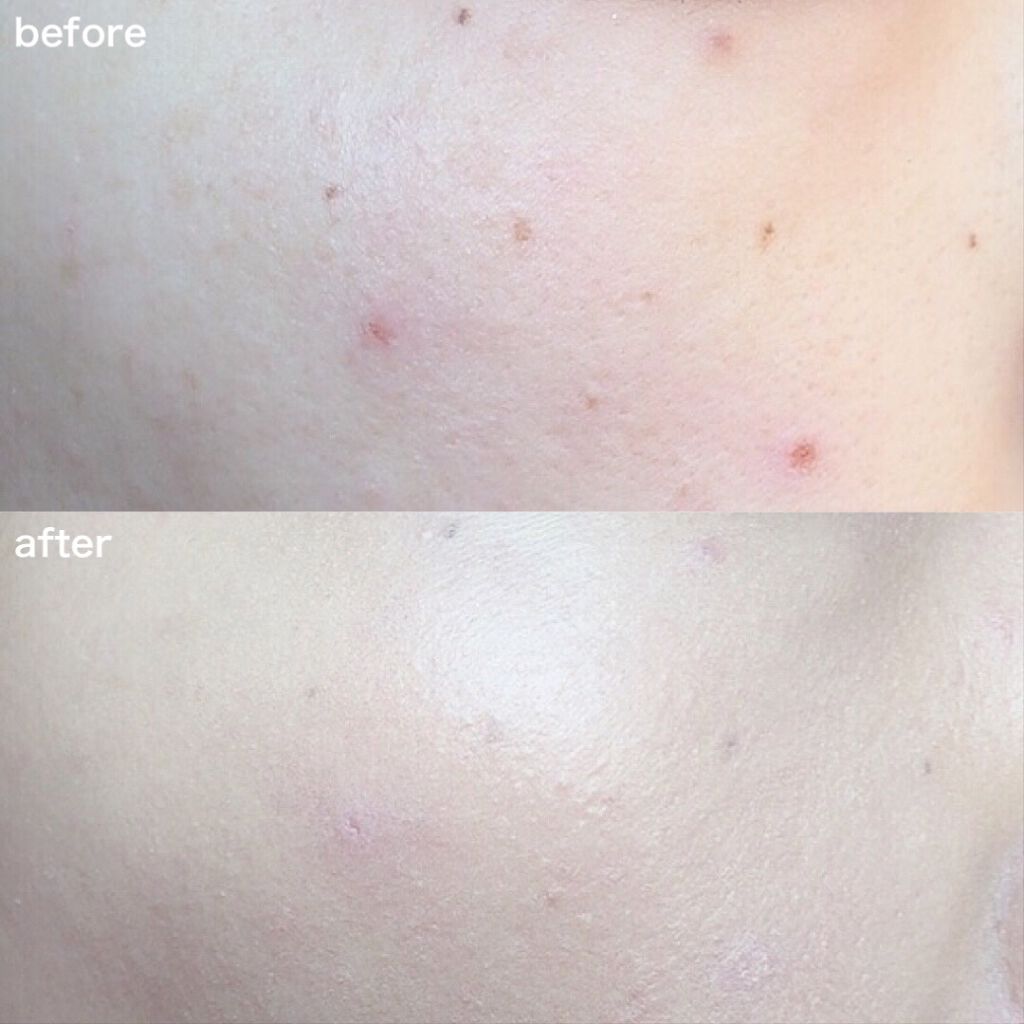 ~トゥー フェイスド ハングオーバー~ ピロー バーム リップ トリートメント/Too Faced/リップ美容液を使ったクチコミ(4枚目)