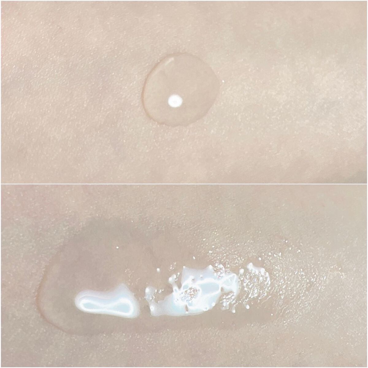 アクネケア ジェル乳液 <医薬部外品>/ファンケル/乳液を使ったクチコミ(5枚目)