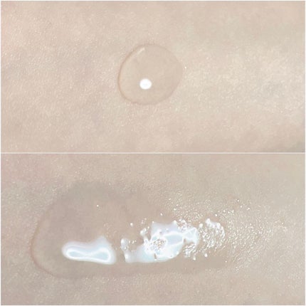 アクネケア ジェル乳液 <医薬部外品>/ファンケル/乳液を使ったクチコミ(5枚目)