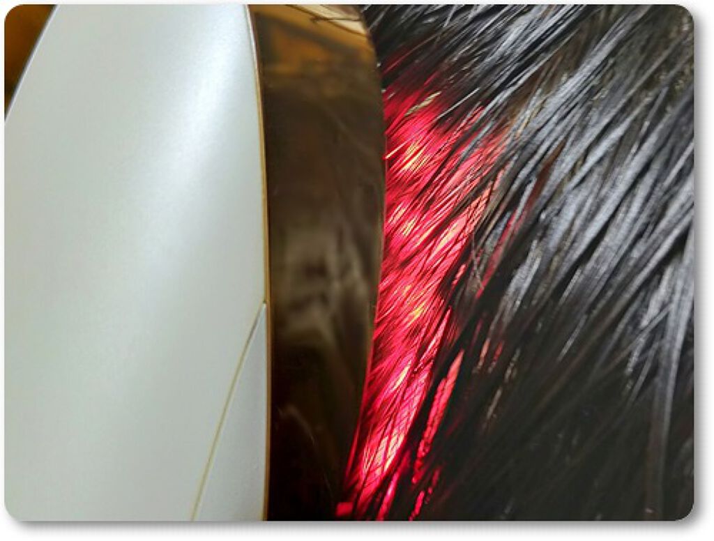 スカルプリフト/mysé(ミーゼ)/ヘアケアグッズを使ったクチコミ（3枚目）