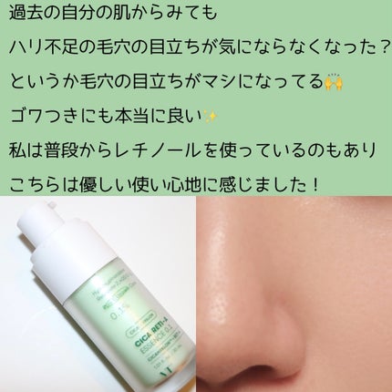 シカレチA エッセンス0.1/VT/美容液を使ったクチコミ(4枚目)