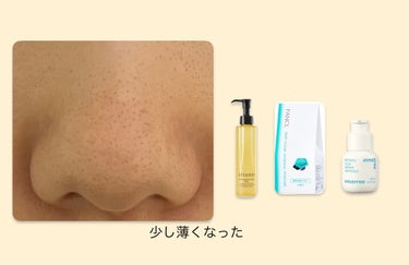 パーフェクトホイップu/SENKA（専科）/洗顔フォームを使ったクチコミ（8枚目）