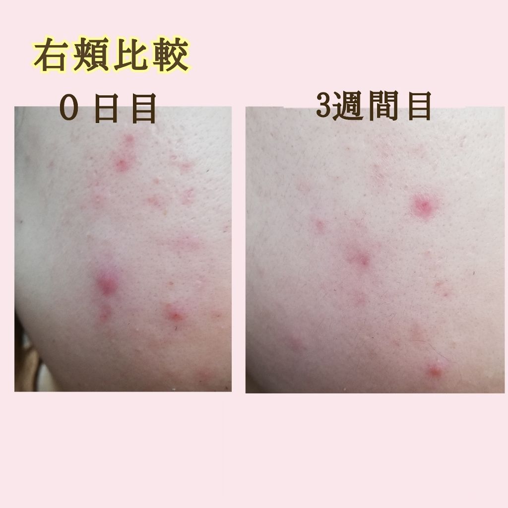 ザ・タイムR アクア/IPSA/化粧水を使ったクチコミ(3枚目)
