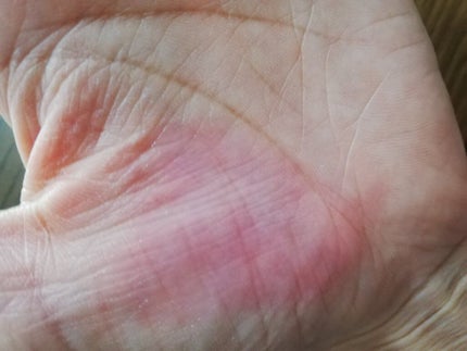 YNM キャンディーハニーリップバーム/YNM/リップバームを使ったクチコミ(4枚目)