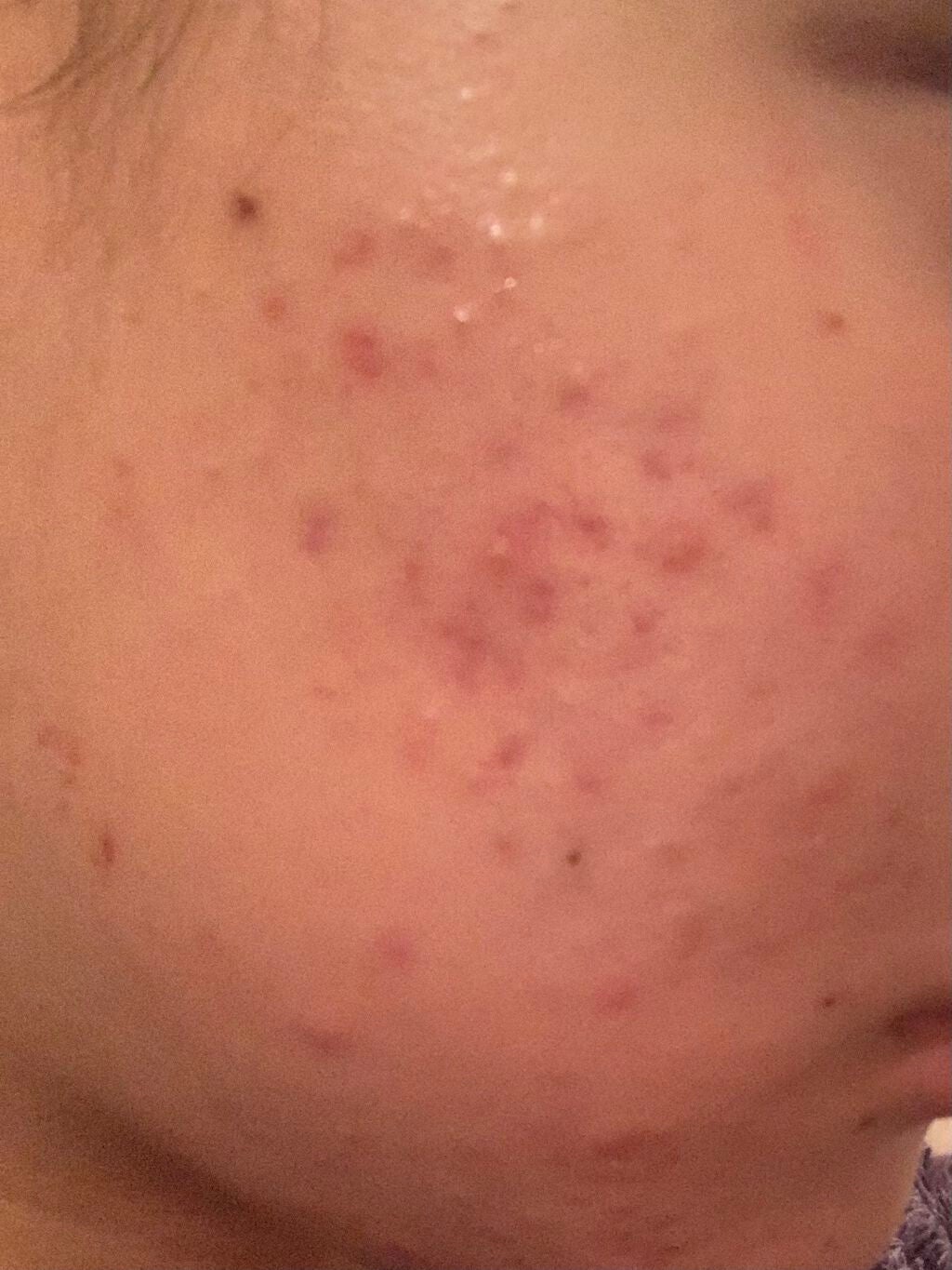 とろり on LIPS 「ちょっと照明が茶色いとこで撮ってしまったせいでサウナあがりみた..」(1枚目)