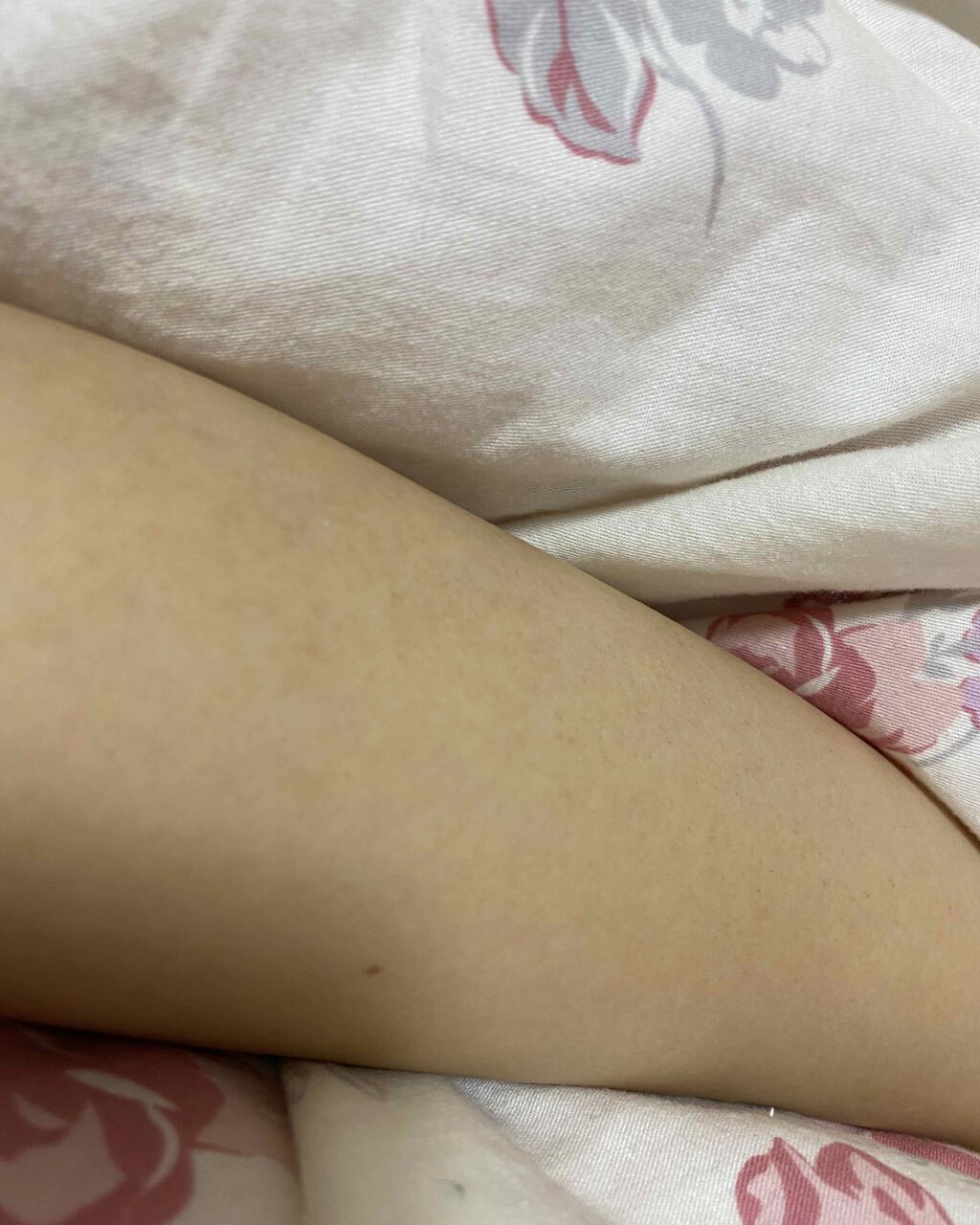 ブラウンシルクエキスパート （光美容器）/ブラウン/家庭用脱毛器を使ったクチコミ（1枚目）