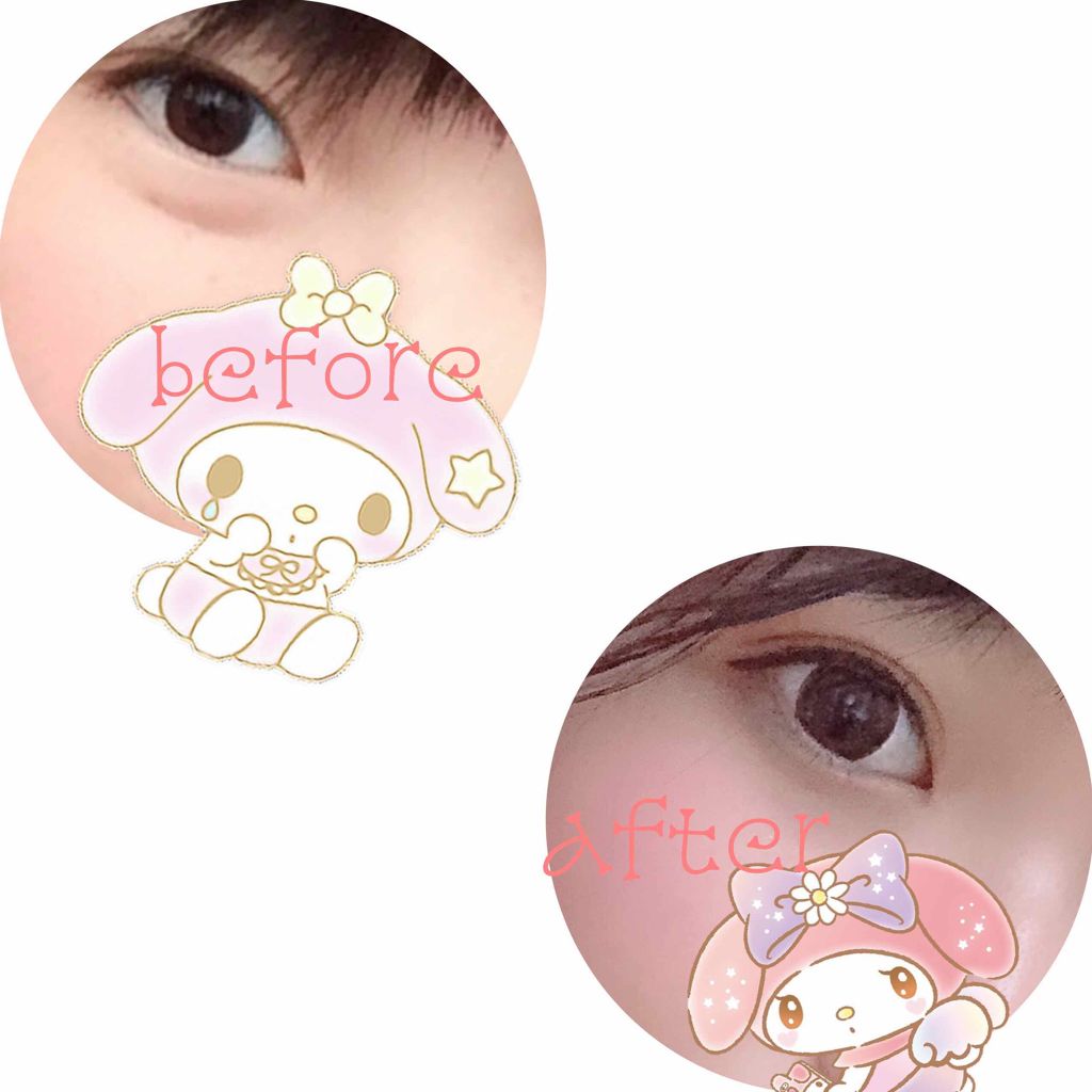 のびーるアイテープ（絆創膏タイプ、レギュラー）/DAISO/二重まぶた用アイテムを使ったクチコミ（1枚目）