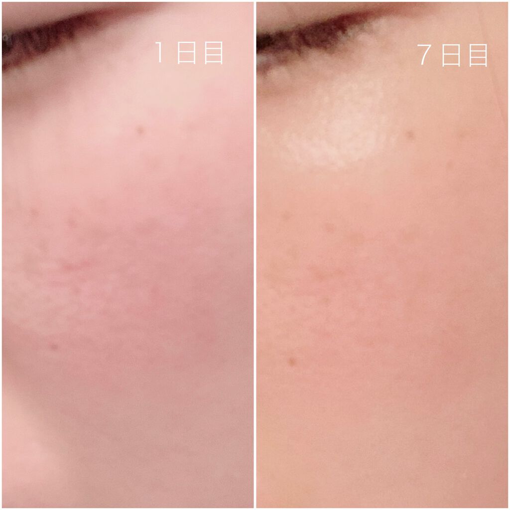 モアリッチパック/meeth/シートマスク・パックを使ったクチコミ(5枚目)