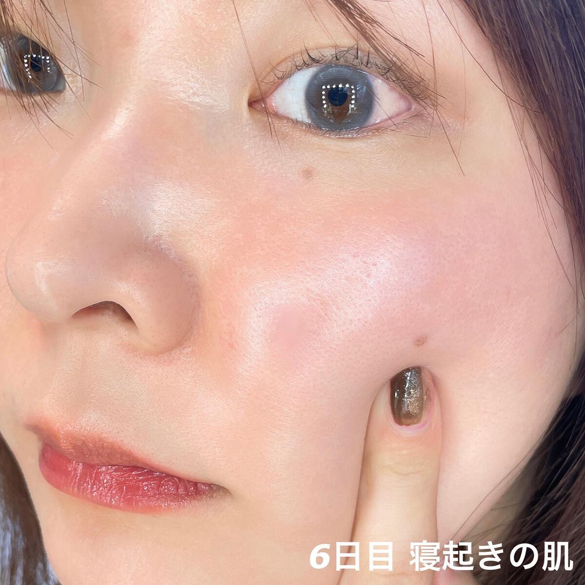 ダーマスキンピーリング/BQCELL/その他キットセットを使ったクチコミ（3枚目）