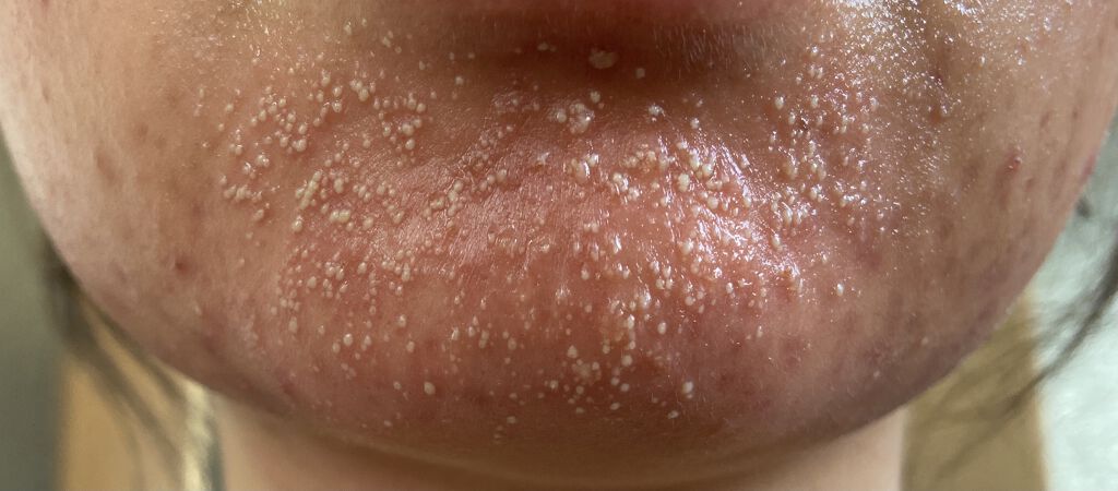 マデカソ CICAクリーム  /A’pieu/フェイスクリームを使ったクチコミ（2枚目）