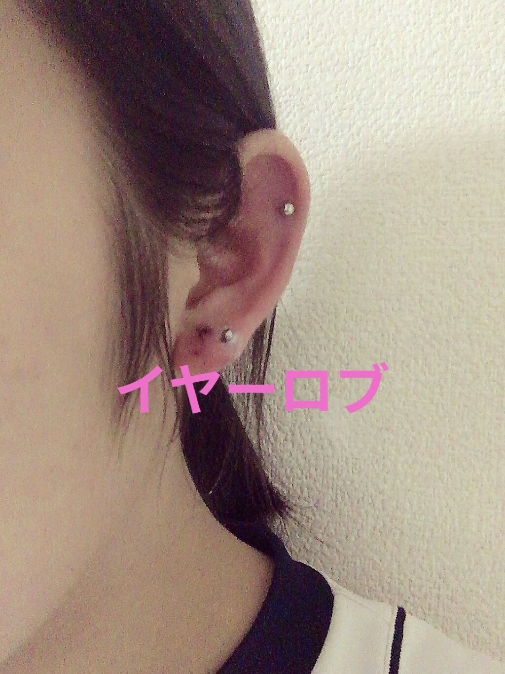 オキシドール(医薬品)/日本薬局方/その他を使ったクチコミ（1枚目）