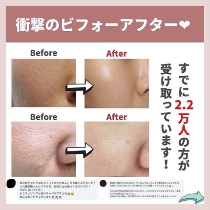 あなたの肌に合ったスキンケア💐コーくん先生 on LIPS 「【当てはまったヤバい】こんな人は毛穴の開き一生消えません.
...」(7枚目)