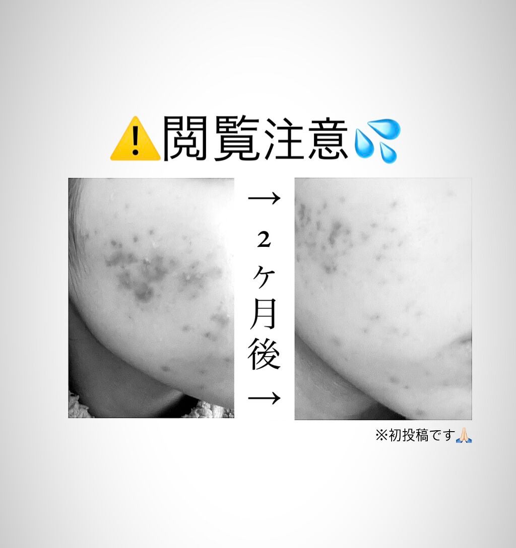 うるおいジェリー とてもしっとり/ビオレ/オールインワン化粧品を使ったクチコミ(1枚目)