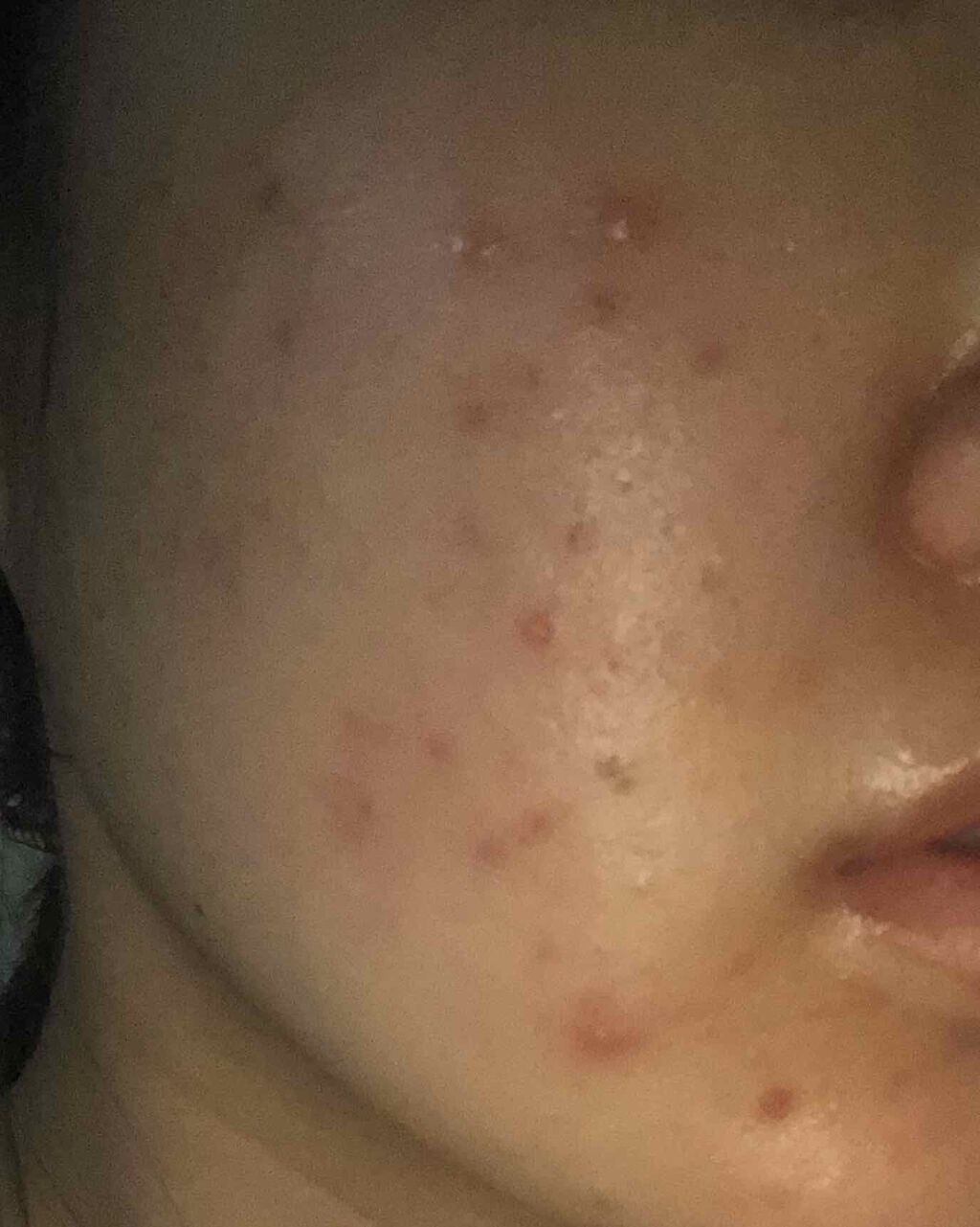 敏感肌用薬用美白美容液/無印良品/美容液を使ったクチコミ(3枚目)