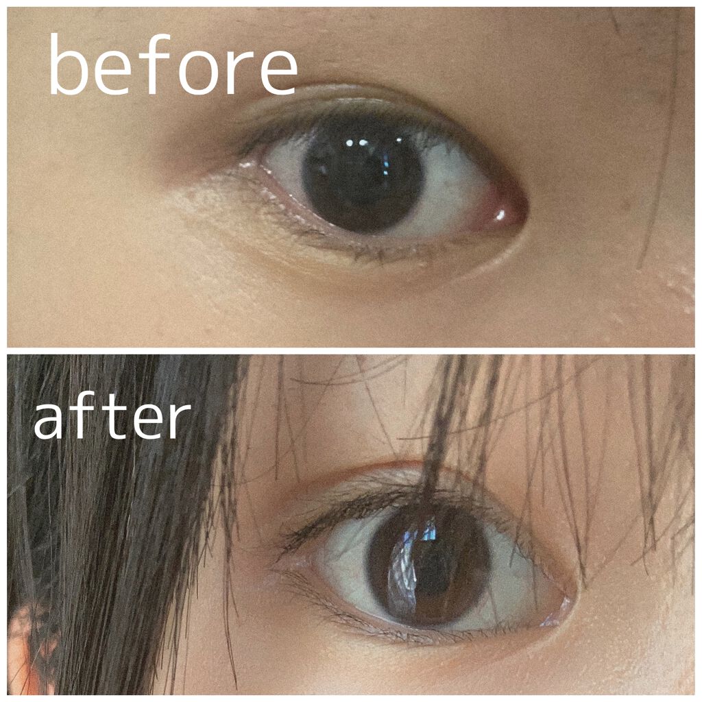 のびーるアイテープ（絆創膏タイプ、レギュラー）/DAISO/二重まぶた用アイテムを使ったクチコミ（1枚目）