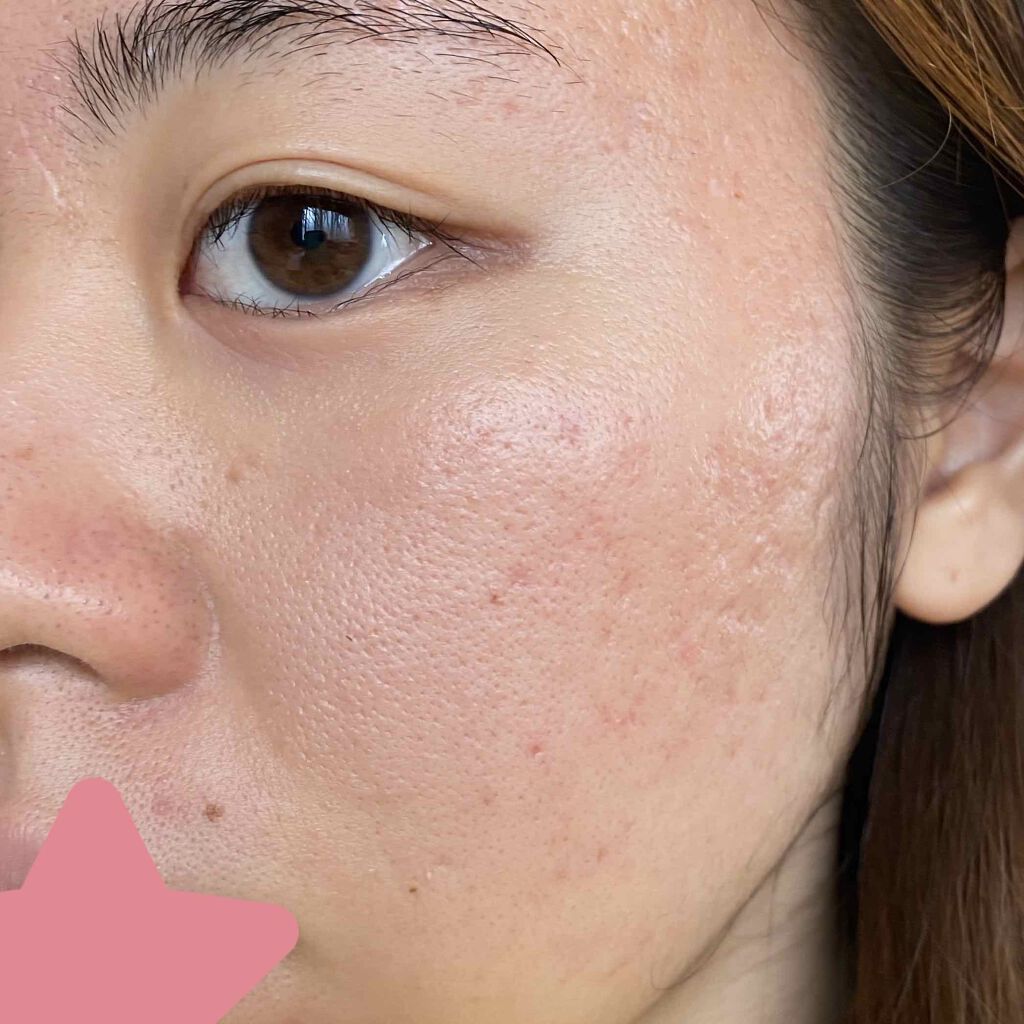 化粧水・敏感肌用・しっとりタイプ/無印良品/化粧水を使ったクチコミ(2枚目)