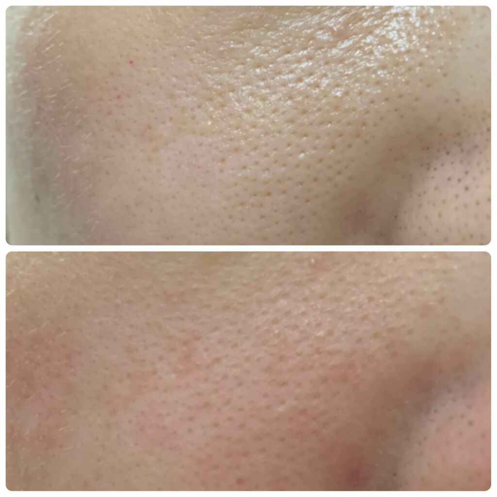 チークポアパッチ/北の快適工房/シートマスク・パックを使ったクチコミ(3枚目)