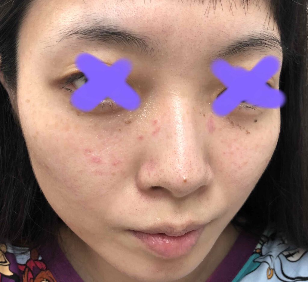 まな@YouTube on LIPS 「※iPhoneの純正カメラ加工なしでございます!!!⚠️さぁ、..」(2枚目)