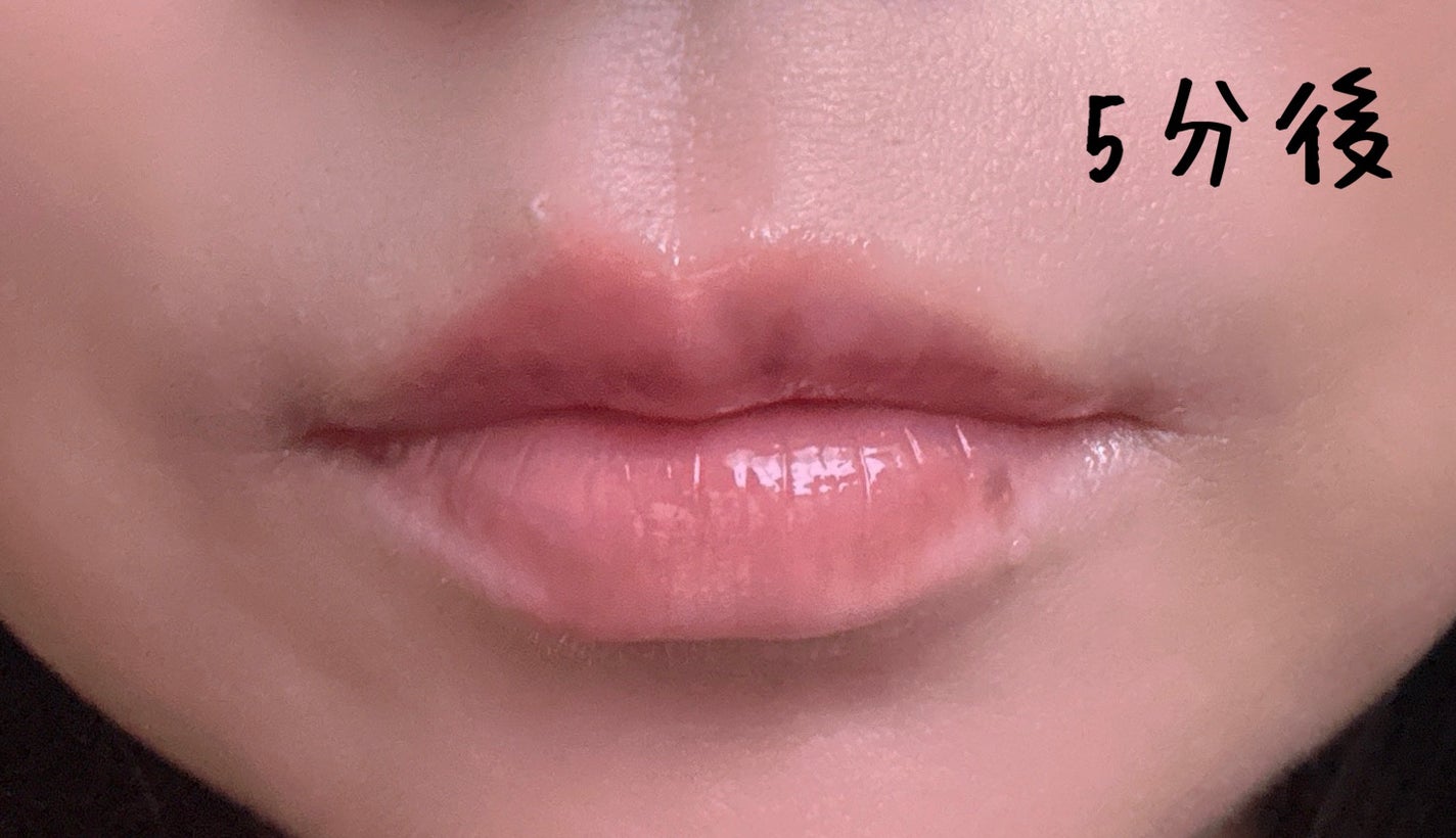 ボリュームリッププランパー/BANILA CO/リッププランパーを使ったクチコミ(6枚目)