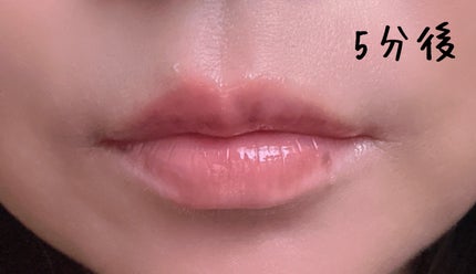 ボリュームリッププランパー/BANILA CO/リッププランパーを使ったクチコミ(6枚目)