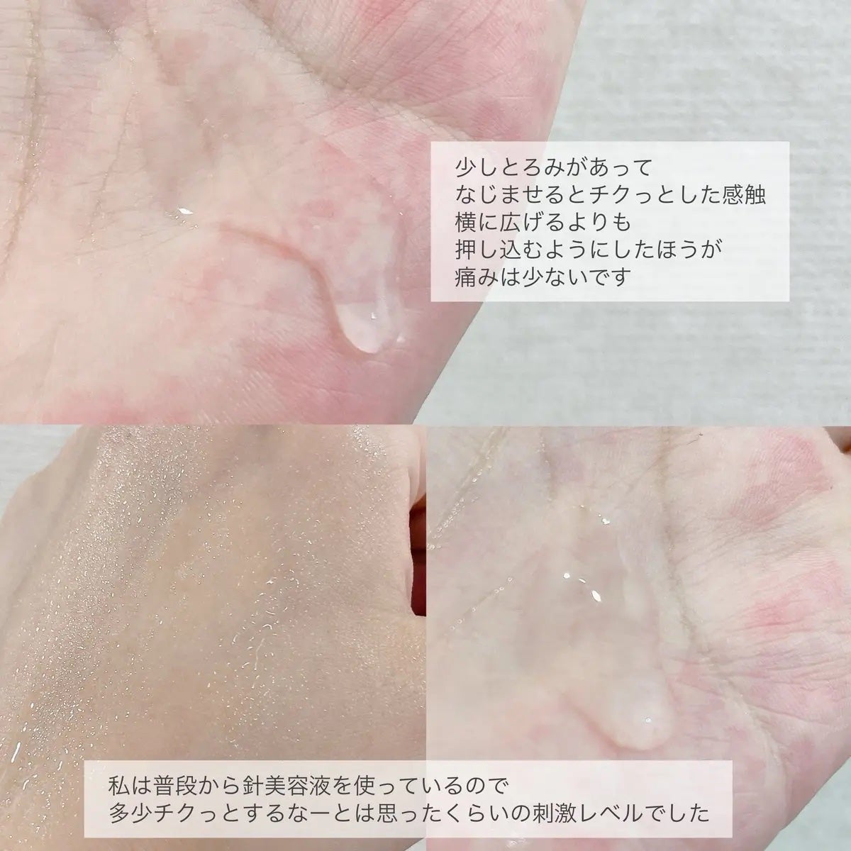 リードルリッチ パワーニードルセラム/REEDLE RICH/美容液を使ったクチコミ(4枚目)