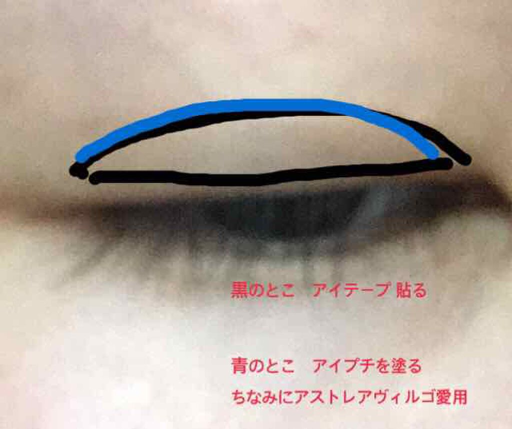 LJ 二重テープ ヌーディポイント/LOUJENE/二重まぶた用アイテムを使ったクチコミ（3枚目）